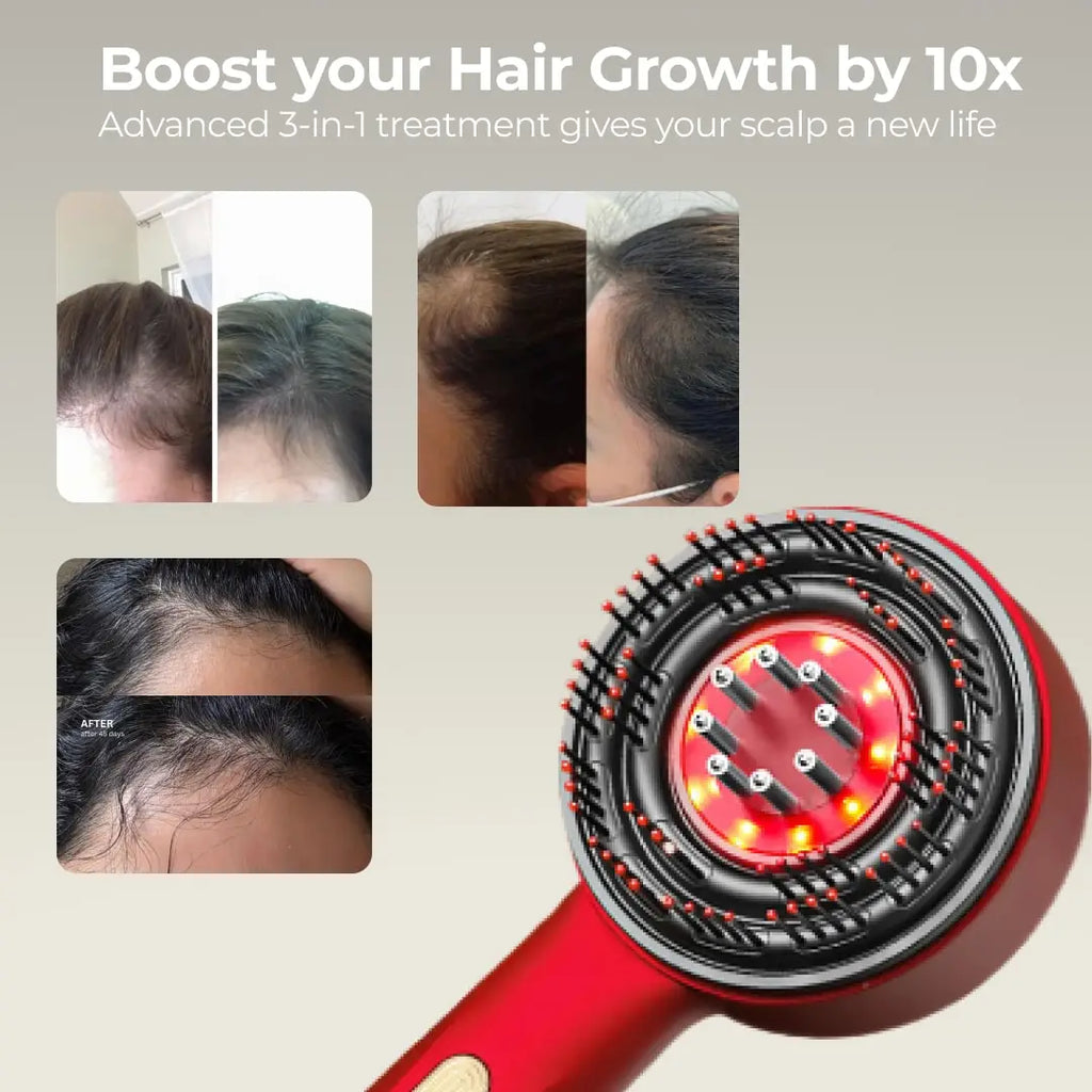 Zulfeinn Z3S - 3 in 1 Hair Growth Scalp Massager with Red Light Therapy